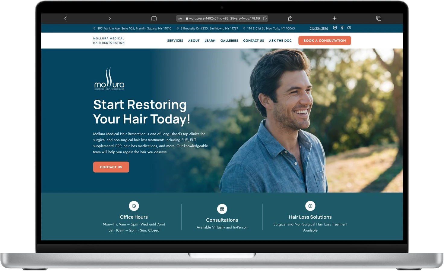 Mollura Hair Transplant redesign homepage on laptop