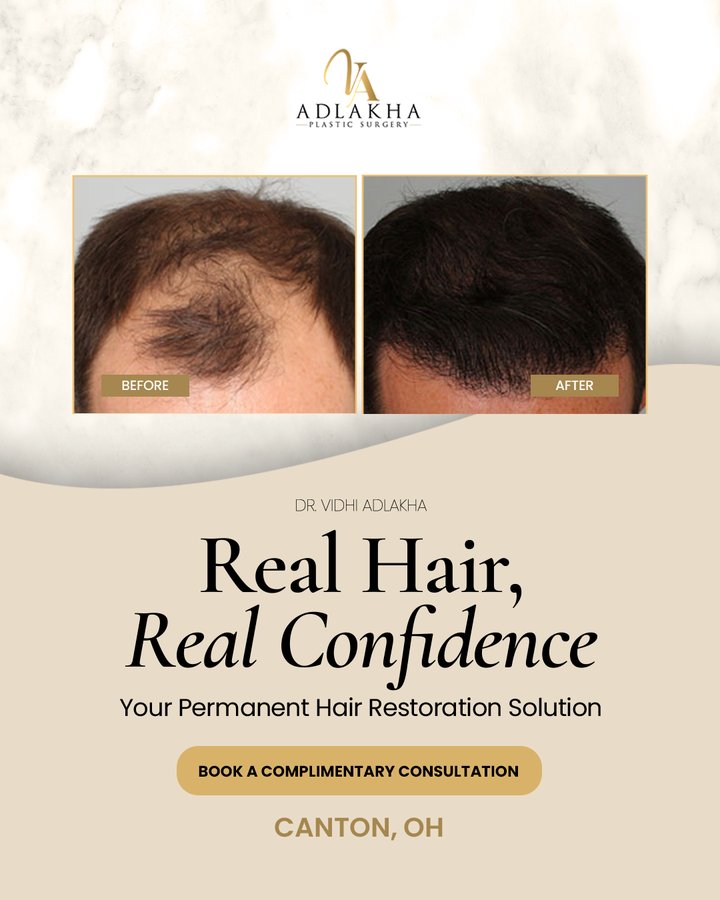 Adlakha ad variant A4