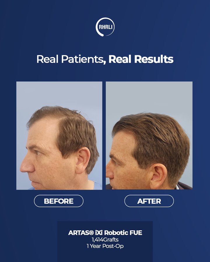 RHRLI real patients real results post